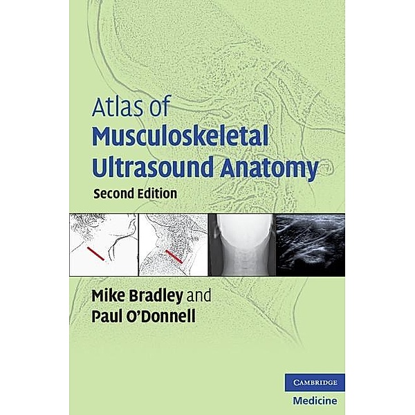 Atlas of Musculoskeletal Ultrasound Anatomy, Mike Bradley