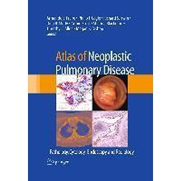 Atlas of Neoplastic Pulmonary Disease