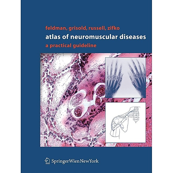 Atlas of Neuromuscular Diseases, Eva L. Feldman, Wolfgang Grisold, James W. Russell, Udo A. Zifko