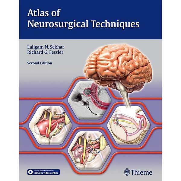 Atlas of Neurosurgical Techniques