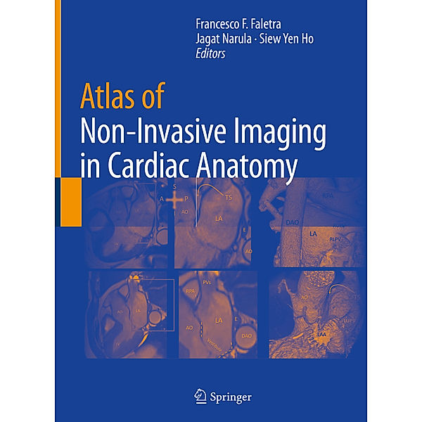 Atlas of Non-Invasive Imaging in Cardiac Anatomy