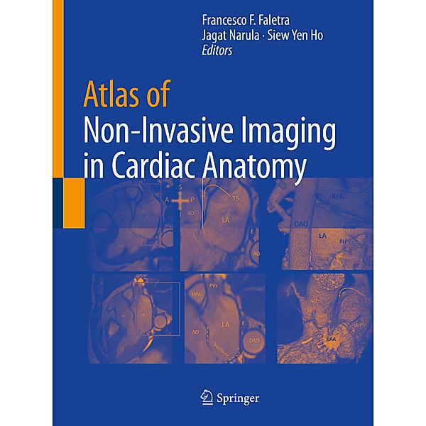 Atlas of Non-Invasive Imaging in Cardiac Anatomy