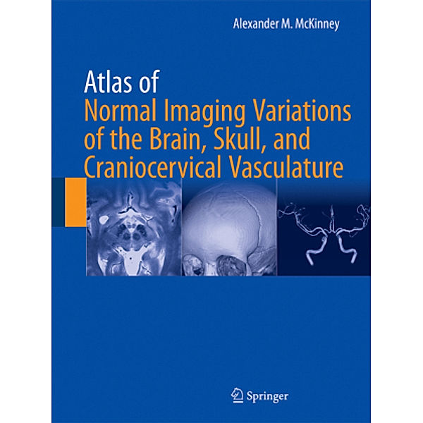 Atlas of Normal Imaging Variations of the Brain, Skull, and Craniocervical Vasculature , 2 Teile, Alexander M. McKinney