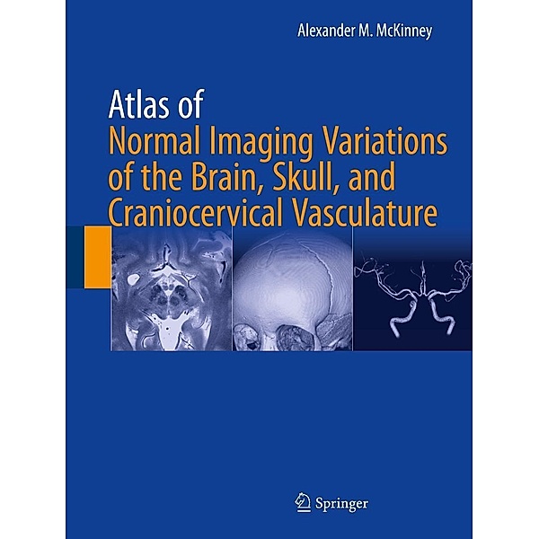 Atlas of Normal Imaging Variations of the Brain, Skull, and Craniocervical Vasculature, Alexander M. McKinney