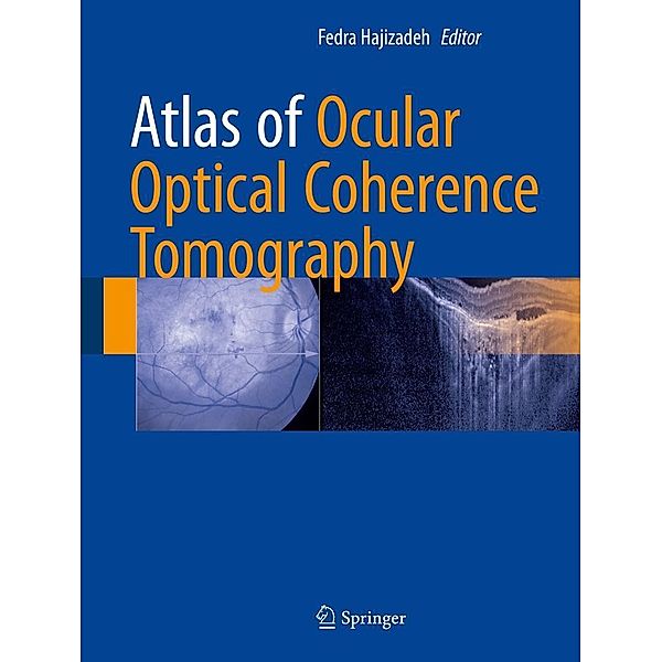 Atlas of Ocular Optical Coherence Tomography