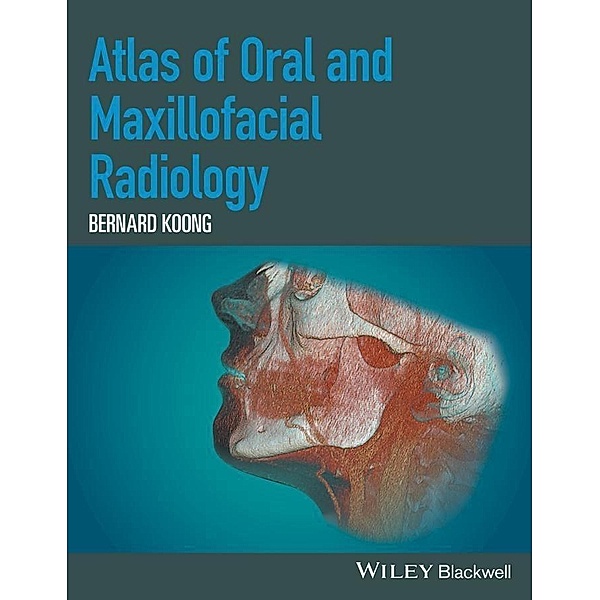 Atlas of Oral and Maxillofacial Radiology, Bernard Koong