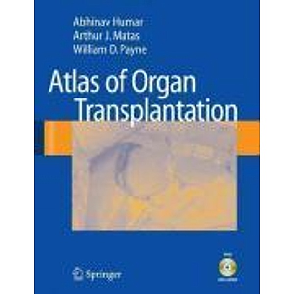 Atlas of Organ Transplantation / Springer, Abhinav Humar, Arthur J. Matas, William D. Payne