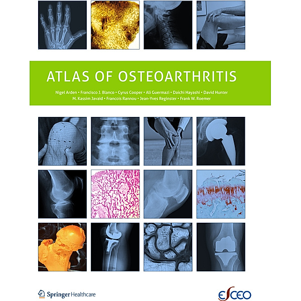 Atlas of Osteoarthritis, Nigel Arden, Francisco Blanco, C. Cooper
