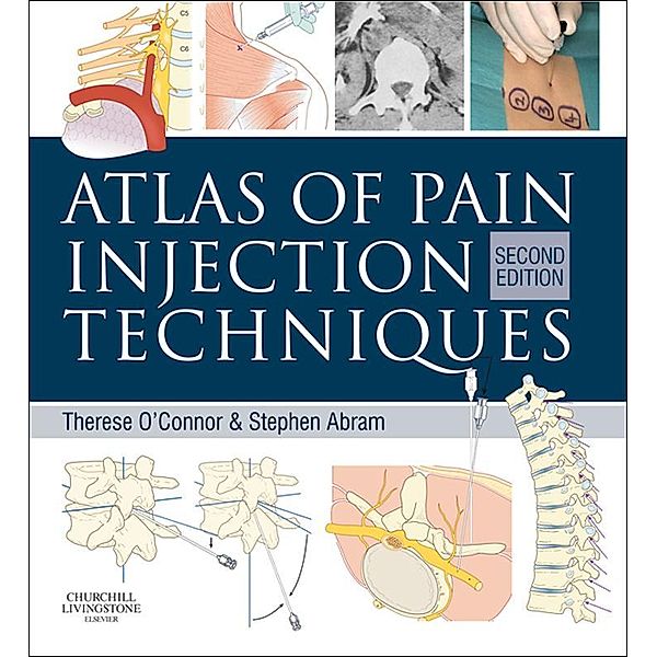 Atlas of Pain Injection Techniques E-Book, Therese C. O'Connor, Stephen E. Abram