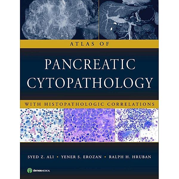 Atlas of Pancreatic Cytopathology, Syed Z. Ali, Yener S. Erozan, Ralph H. Hruban