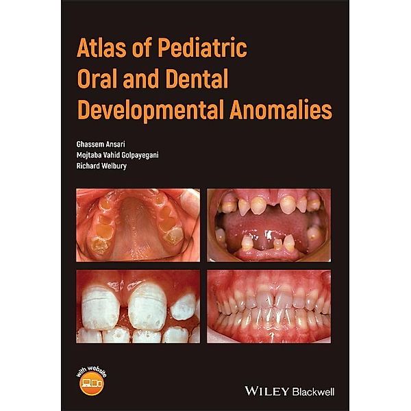Atlas of Pediatric Oral and Dental Developmental Anomalies, Ghassem Ansari, Mojtaba Vahid Golpayegani, Richard Welbury