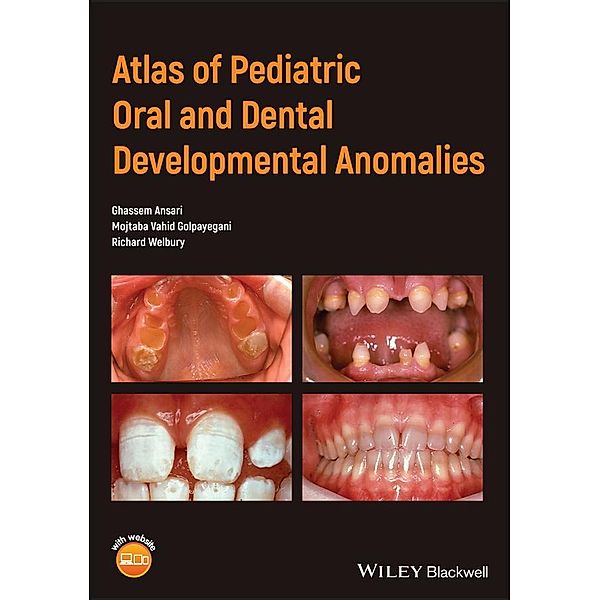 Atlas of Pediatric Oral and Dental Developmental Anomalies, Ghassem Ansari, Mojtaba Vahid Golpayegani, Richard Welbury