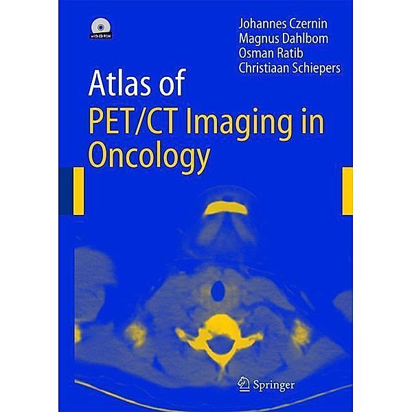 Atlas of PET/CT Imaging in Oncology, Johannes Czernin, Magnus Dahlbom, O. Ratib, Christiaan Schiepers