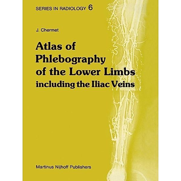 Atlas of Phlebography of the Lower Limbs / Series in Radiology Bd.6, J. Chermet