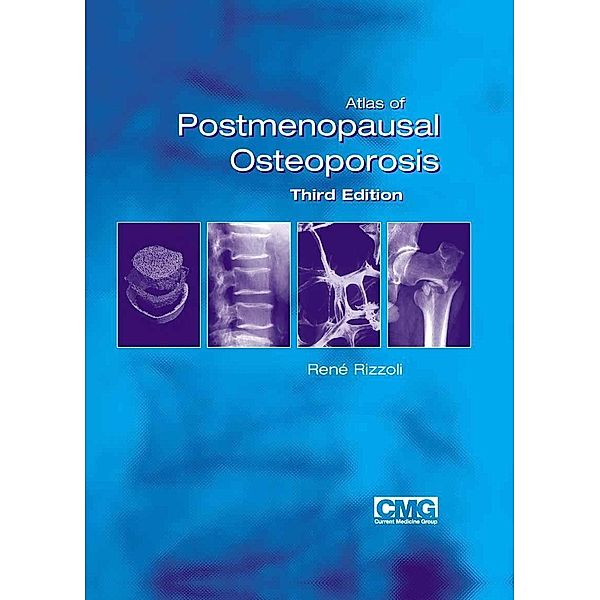 Atlas of Postmenopausal Osteoporosis, René Rizzoli