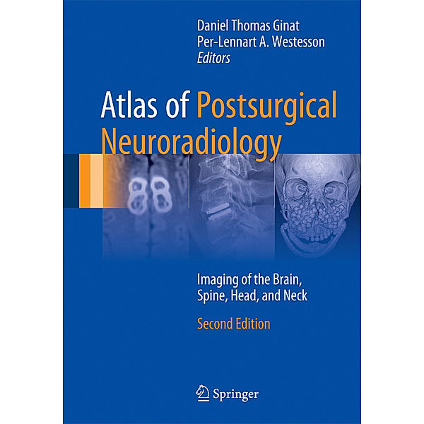 Atlas of Postsurgical Neuroradiology