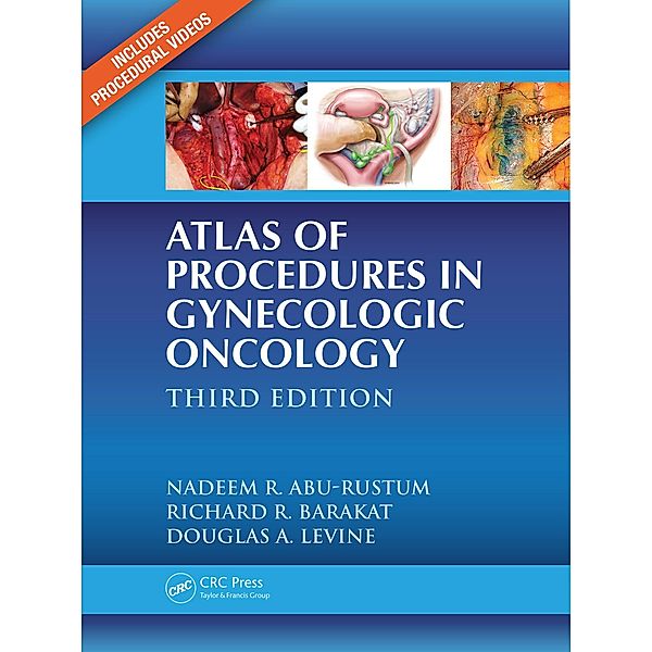 Atlas of Procedures in Gynecologic Oncology, Nadeem R. Abu-Rustum, Richard R. Barakat, Douglas A. Levine