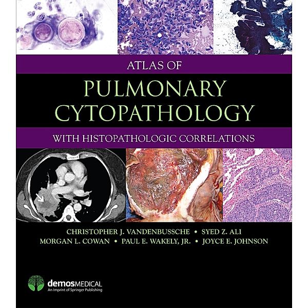 Atlas of Pulmonary Cytopathology, Christopher J. Vandenbussche, Syed Z. Ali, Morgan L. Cowan, Anil V. Parwani, Paul E. Wakely, Joyce E. Johnson