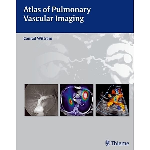Atlas of Pulmonary Vascular Imaging, Conrad Wittram
