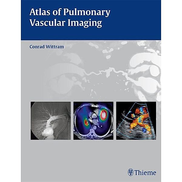 Atlas of Pulmonary Vascular Imaging, Conrad Wittram