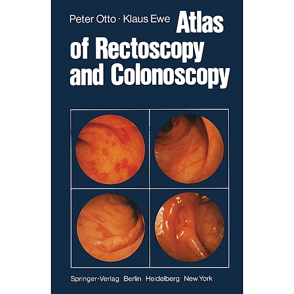 Atlas of Rectoscopy and Coloscopy, P. Otto, K. Ewe