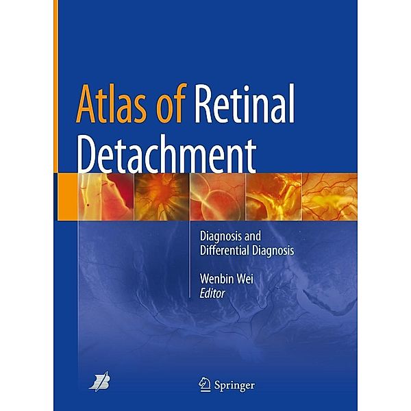 Atlas of Retinal Detachment