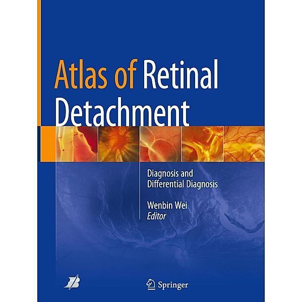 Atlas of Retinal Detachment