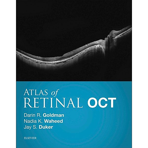 Atlas of Retinal OCT E-Book, Darin Goldman, Nadia K. Waheed, Jay S. Duker