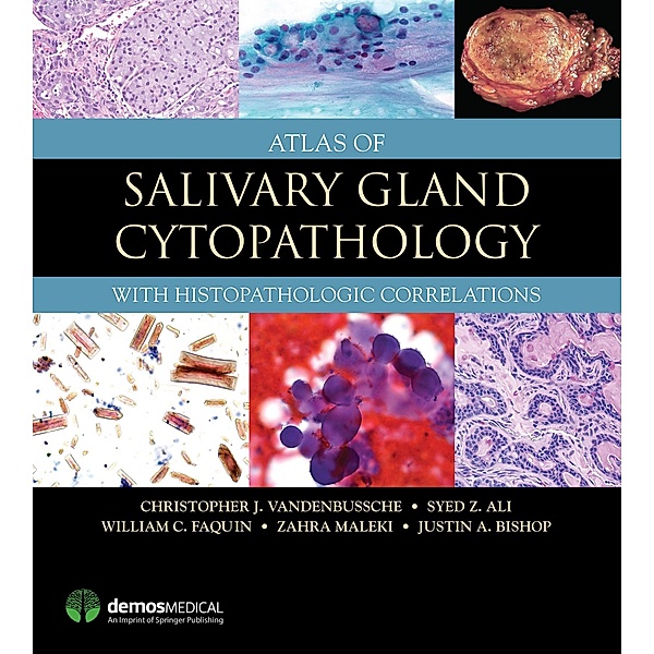 Atlas of Salivary Gland Cytopathology, Christopher J. Vandenbussche, Syed Z. Ali, William C. Faquin, Zahra Maleki, Justin Bishop