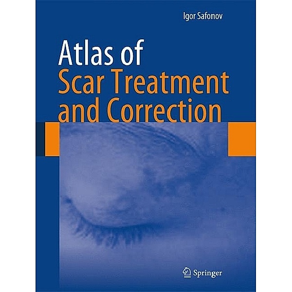 Atlas of Scar Treatment and Correction, Igor Safonov