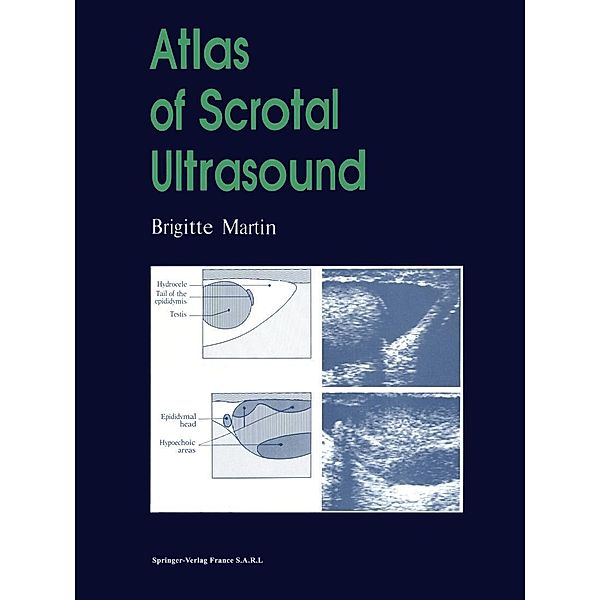 Atlas of Scrotal Ultrasound, Brigitte Martin