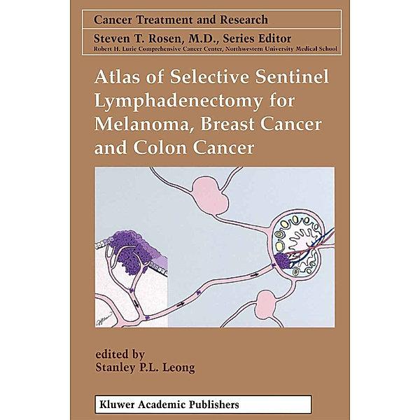 Atlas of Selective Sentinel Lymphadenectomy for Melanoma, Breast Cancer and Colon Cancer
