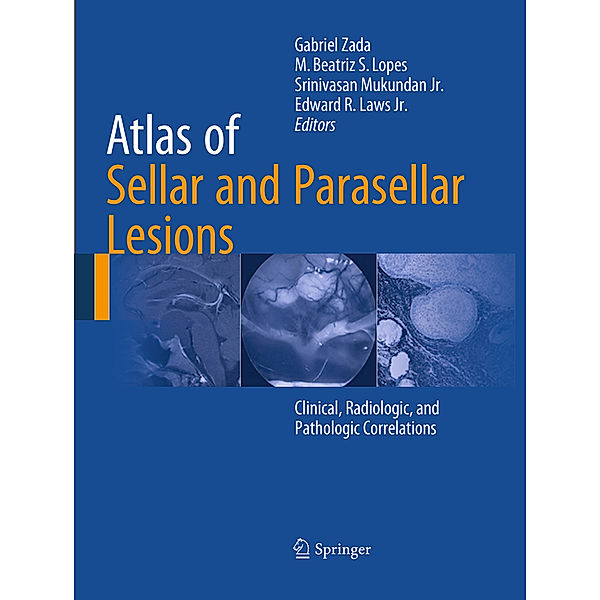 Atlas of Sellar and Parasellar Lesions