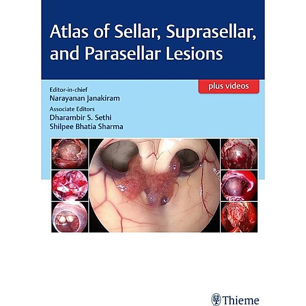 Atlas of Sellar, Suprasellar, and Parasellar Lesions