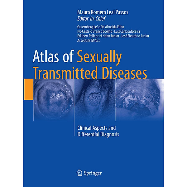 Atlas of Sexually Transmitted Diseases