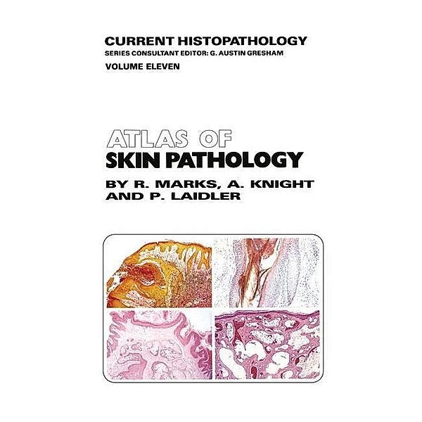 Atlas of Skin Pathology, R. M. Marks, A. G. Knight, P. Laidler