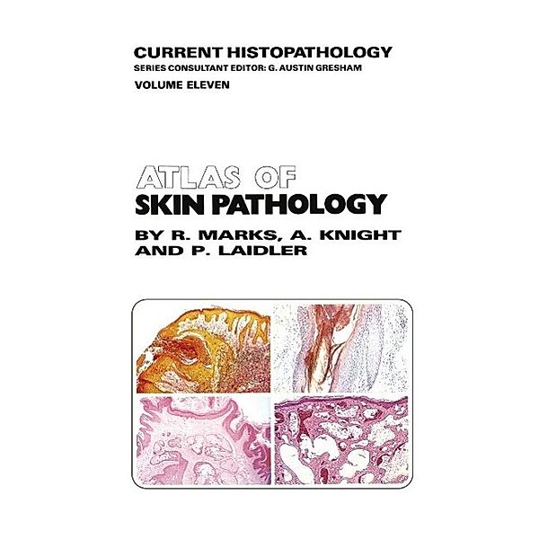 Atlas of Skin Pathology / Current Histopathology Bd.11, R. M. Marks, A. G. Knight, P. Laidler