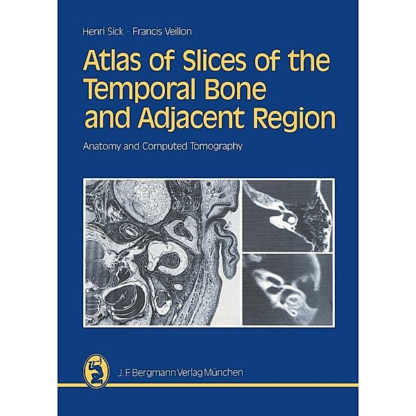 Atlas of Slices of the Temporal Bone and Adjacent Region, Henri Sick, Francis Veillon