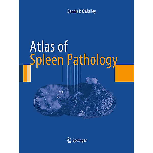 Atlas of Spleen Pathology, Dennis P. O'Malley
