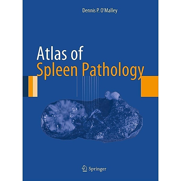 Atlas of Spleen Pathology / Atlas of Anatomic Pathology, Dennis P. O'Malley