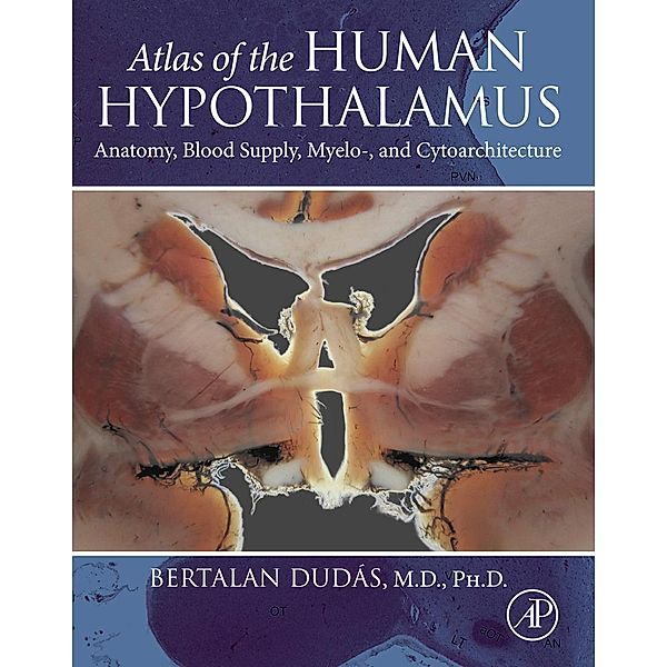 Atlas of the Human Hypothalamus, Bertalan Dudas