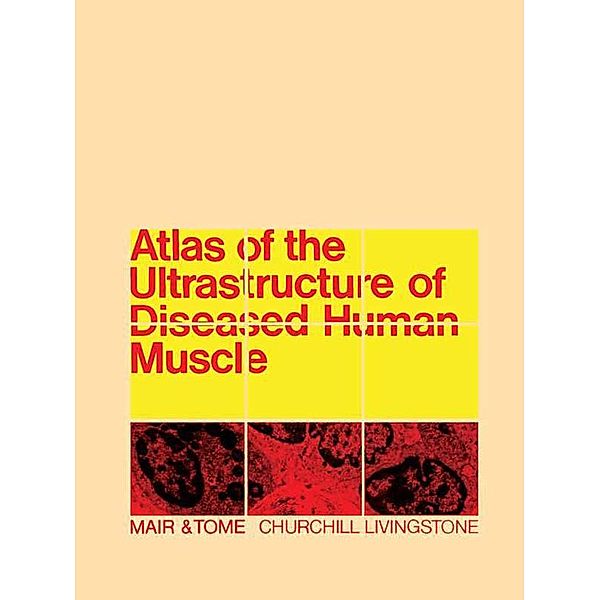 Atlas of the Ultrastructure of Diseased Human Muscle, W G P Mair, F M S Tomé
