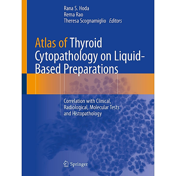 Atlas of Thyroid Cytopathology on Liquid-Based Preparations