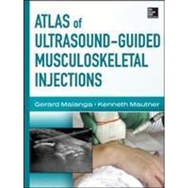 Atlas of Ultrasound-Guided Musculoskeletal Injections, Gerard Malanga, Kenneth Mautner