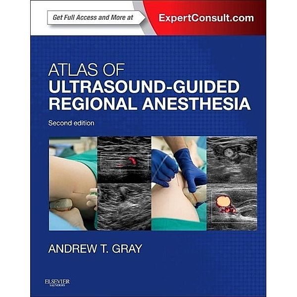 Atlas of Ultrasound-Guided Regional Anesthesia, Andrew T. Gray