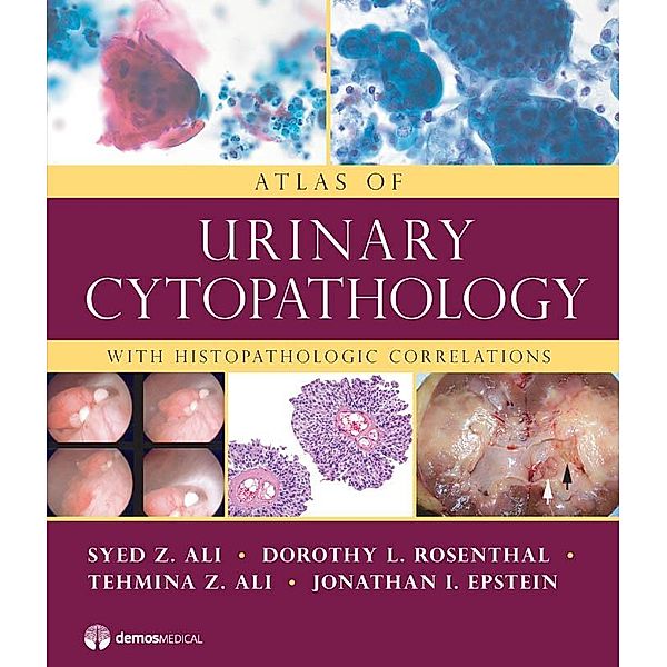Atlas of Urinary Cytopathology, Syed Z. Ali, Tehmina Z. Ali, Jonathan I. Epstein, Dorothy L. Rosenthal