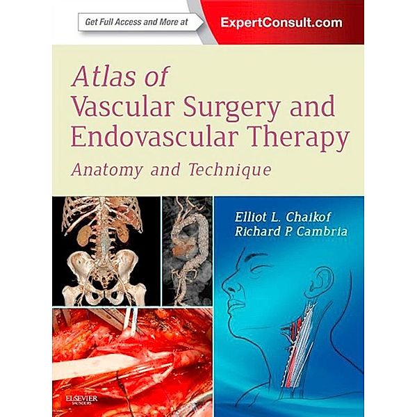Atlas of Vascular Surgery and Endovascular Therapy E-Book, Elliot L. Chaikof, Richard P. Cambria