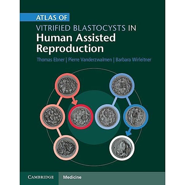Atlas of Vitrified Blastocysts in Human Assisted Reproduction, Thomas Ebner