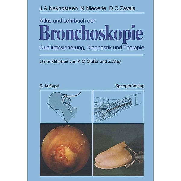 Atlas und Lehrbuch der Bronchoskopie, John A. Nakhosteen, Norbert Niederle, Donald C. Zavala