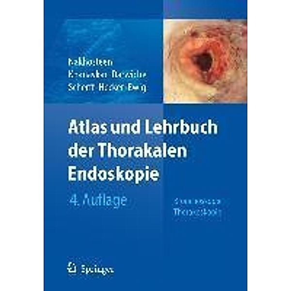 Atlas und Lehrbuch der Thorakalen Endoskopie